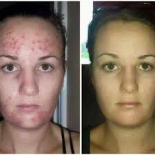 THE BEST 10 HAIR REMOVAL near KIRBAÇ SK 15, İSTANBUL, TURKEY