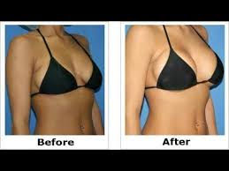 Miracle Oil For Breast Enlargement Tighten Your Saggy Breast In Hindi 2018 Youtube