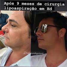 Foram 15 dias muito intenso, ri chorei, deu aula de cirurgia, atendi  pacientes, corria no hospital,uber mãe levava as meninas para as atividades  , aniversário do Rogério e depois do Matheus, e