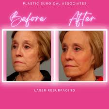 Plastic Surgical Associates of Fort Collins