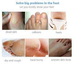Mask For Removing Dead And Dry Skin From Feet This Will Peel Off And Remove The Dried Layer And Make Your Skin Baby Soft And Peeling Mask Feet Care Dead Skin