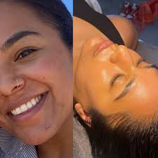 Reviews of Moon Lux Skin & Wellness