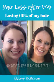 Pin On Extreme Weight Loss Journey