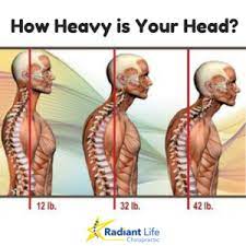The cerebellum (back of brain) is located at the back of the head. Understanding Forward Head Posture Radiant Life Chiropractic
