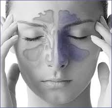 Is removal of nasal polyps painful? Sinus Surgery Restore Normal Sinus The Right Nose