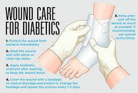 There are many aspects to this, but one you should never overlook is diabetic foot care. Caring For Wounds And Foot Ulcers In Diabetic Patients Sunrise Hospital