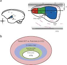Auditory hallucinations are rare in focal epilepsy and consist of basic, stereotyped sounds or sound distortions in the overwhelming majority of cases. Harmonic Template Neurons In Primate Auditory Cortex Underlying Complex Sound Processing Pnas