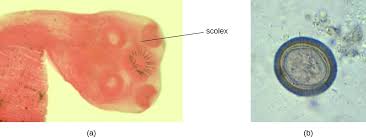 This type of worm is not commonly seen in cats. Helminthic Infections Of The Gastrointestinal Tract Microbiology