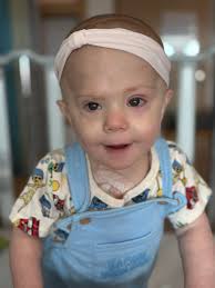 Prayer Request for Amelia's Liver Transplant Recovery