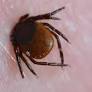 Record Surge in Tick-Borne Encephalitis Cases in Sweden Linked to Climate Change
