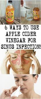 6 Ways To Use Apple Cider Vinegar For Sinus Infection Apple Cider Vinegar Remedies Sinus Infection Remedies Sinusitis