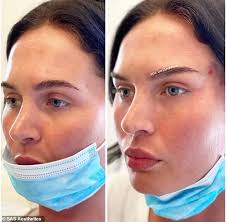 Fox valley ophthalmology located in st. New 30 Minute Lunchtime Fox Eye Treatment Which Lifts The Brows With Invisible Thread Australiannewsreview