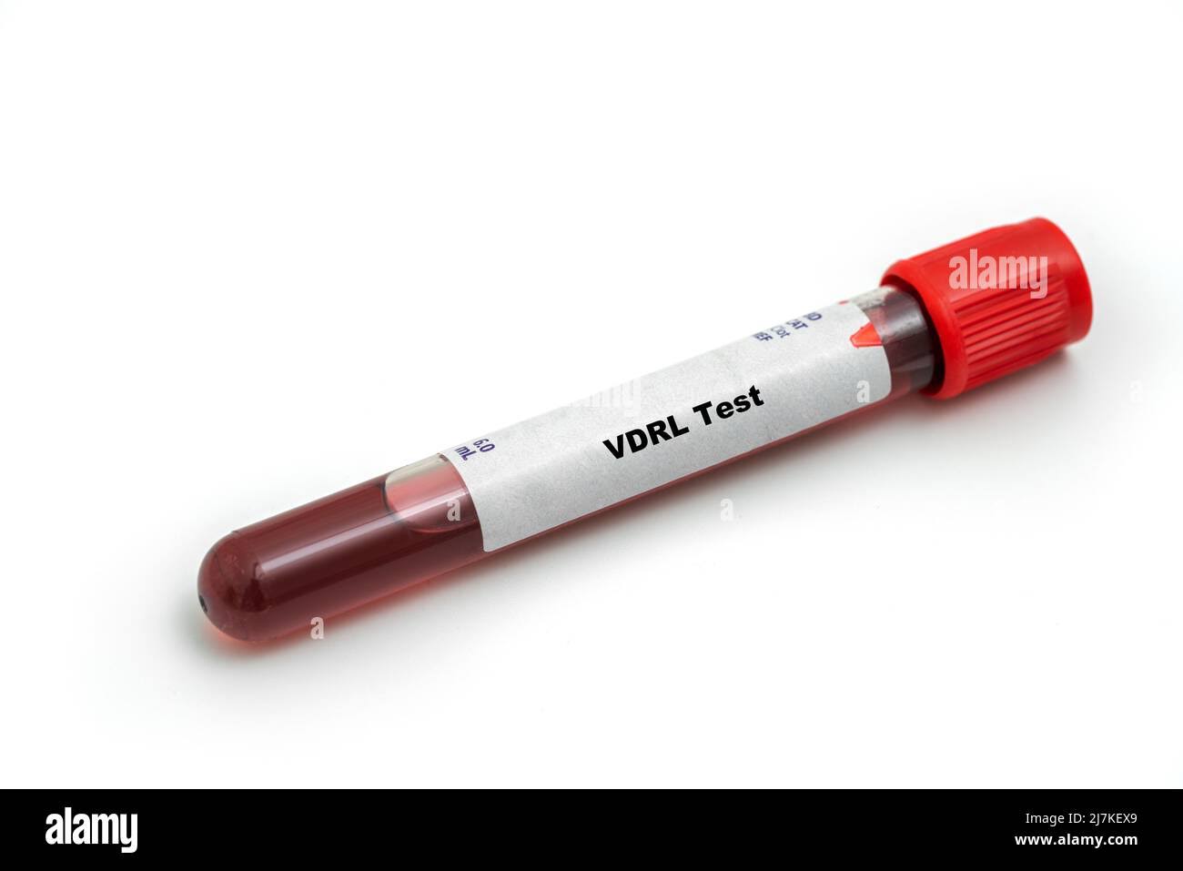 VDRL product image