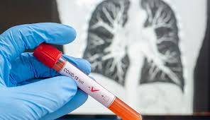 A viral test tells you if you have a current infection. Veterans Can Get Tested For Covid 19 With Va Or Tricare