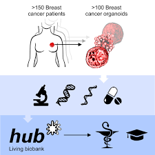 Inflammatory breast cancer symptoms and signs include pain or a bruise in the breast, skin changes in the breast area certain types of cancers known as inflammatory breast cancers may produce redness and warmth of the affected breast, but these are not common symptoms of breast cancer. A Living Biobank Of Breast Cancer Organoids Captures Disease Heterogeneity Cell
