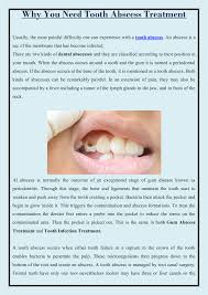 Maybe you would like to learn more about one of these? Why You Need Tooth Abscess Treatment