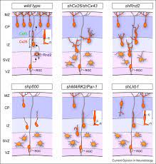 Neuronal Migration Mechanisms In Development And Disease Sciencedirect
