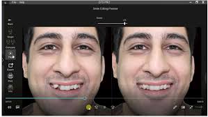 The Art of Dental Simulation Treatment Using the Artificial Inte