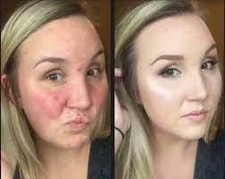 Base Maquillaje Mussbalm – Catalogoxpress