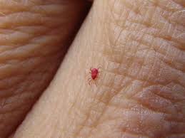 Image result for Trombicula autumnalis bites
