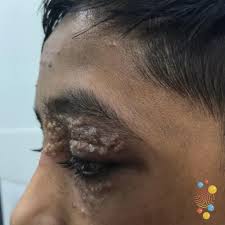 Image result for Exacum zombense