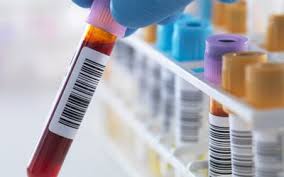 If general urinalysis is performed , it can detect the presence of alcohol in urine upto a maximum of 48 hours after intake of alcohol. How Long Does Alcohol Stay In Your System