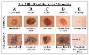 Doctors call these undifferentiated or poorly differentiated tumor cells because they lack the features and structures of normal cells and. 5 Ways To Reduce The Risk Of Skin Cancer