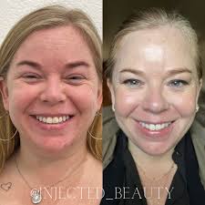 Audrey Crews, APRN, FNP-C