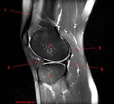 An mri scanner creates highly detailed images of the knee and leg. Atlas Of Knee Mri Anatomy W Radiology