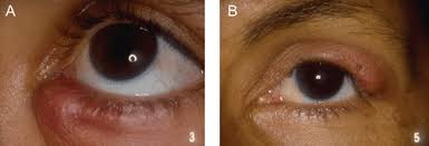 Image result for Blepharis bainesii