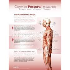 Upper Crossed Syndrome And Lower Crossed Syndrome Poster Upper Cross Syndrome Massage Therapy Upper Cross Syndrome Exercises