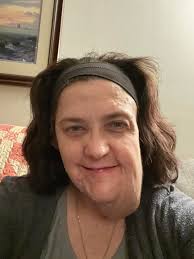 Introduction to neurofibromatosis community