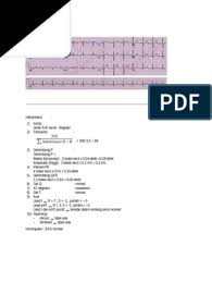 We did not find results for: Contoh Interpretasi Ekg