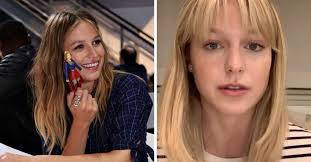 Supergirl Star And Former Glee Star Reveals She Was Abused The actress has a visible scar right above her eyebrows. former glee star reveals she was abused