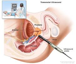 Image result for Prostate Anatomy