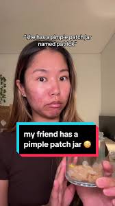 Embarrassing Facts Revealed: My Friend's Pimple Patch Jar Named Patrick