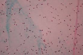 Lo spermiogramma è l'analisi del liquido seminale per valutare la qualità degli spermatozoi, mediante la verifica della loro forma, del loro numero e della loro motilità. Gynepro Esame Del Liquido Seminale Spermiogramma