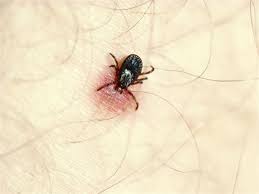 أفضل الطرق لمعالجة جميع أنواع لدغات الحشرات في الصيف مصراوى