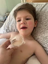 The boy's family says he will have to relearn how to walk, talk and eat.