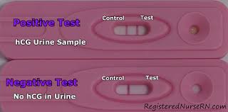 We did not find results for: How To Administer Or Take A Pregnancy Test