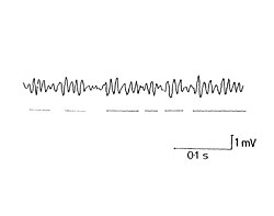 Image result for Visual Fixation