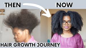 At this point into my journey i was still convinced that the candida overgrowth condition i was struggling with had. How I Grew My Natural Hair 30inches Long As A Black Woman Video Igbocurls
