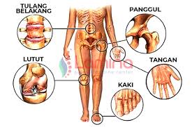 Maybe you would like to learn more about one of these? Penyebab Nyeri Sendi 15 Aktivitas Yang Perlu Anda Ketahui Patella