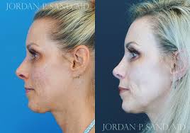 Jordan P. Sand, M.D., F.A.C.S.