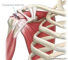 Shoulder anatomy is an elegant piece of machinery having the greatest range of motion of any joint in the body. Shoulder Injuries Perth Cannington Chiro