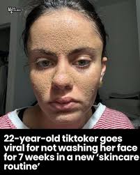 In a recent video call, Zakher assured viewers that she's doing well and,  as of five days ago, has begun using just water to cleanse her face.