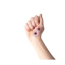 Swollen Snake Bites Temporary Tattoo Pack Snake Bites Tattoos Hand Tattoos
