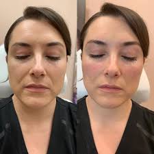 Black Diamond Rejuvenation Center