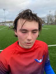 Pole Photo Estaca‎