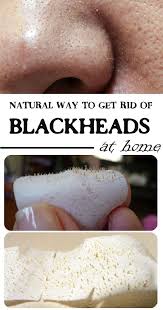 Account Suspended Get Rid Of Blackheads Blackheads Deep Blackheads